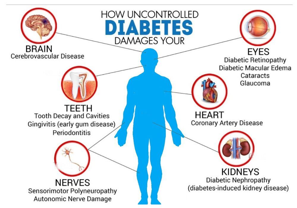 Thumb immense diabetes & thyriod clinics